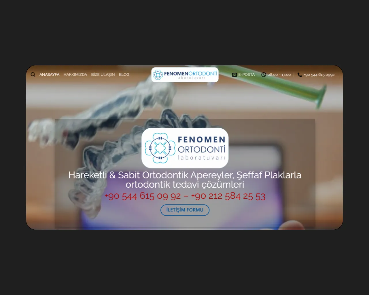 FenomenOrtodonti